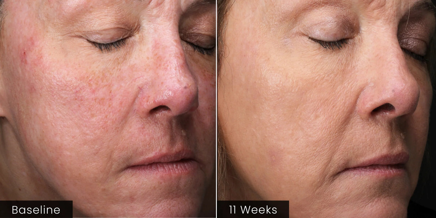 INTENSE Serum Our Most Advanced Exosome Serum