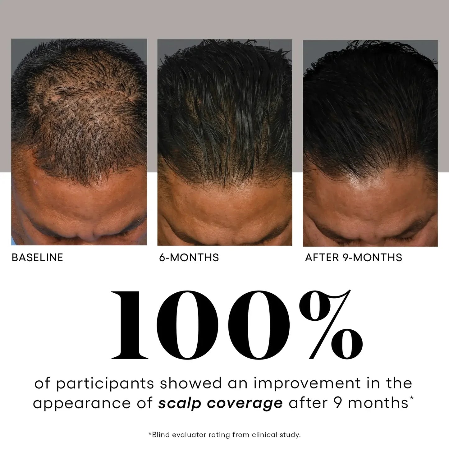 HAIR Serum  Targeted Renewal for the Scalp and Hair