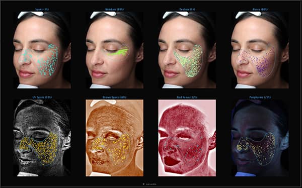 3D Skin Analysis