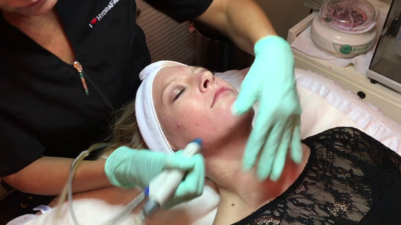 Acne & the HydraFacial