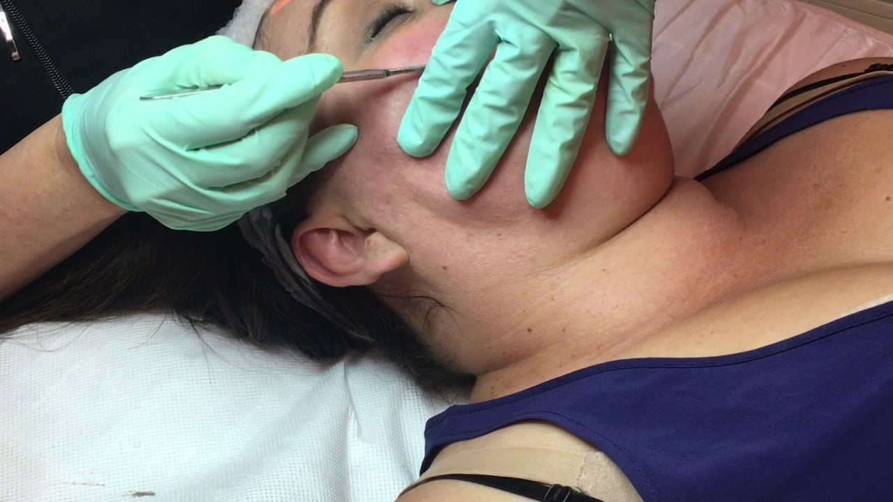 Dermaplane